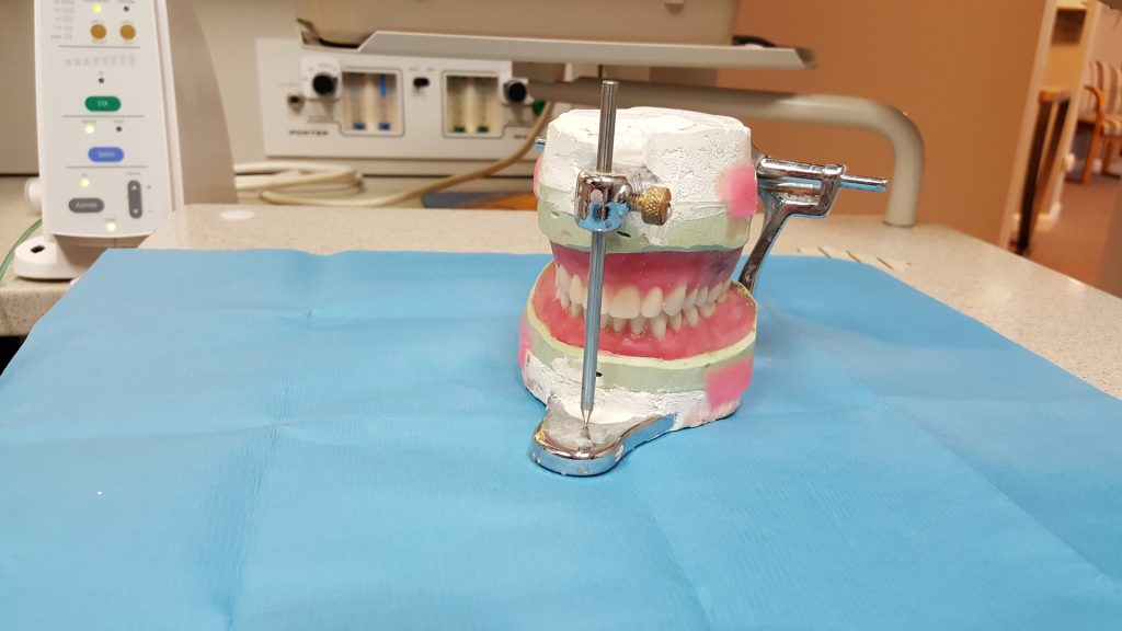 Denture, made of dental impression plaster